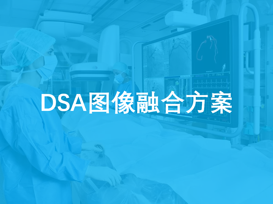 DSA手术室图像融合方案